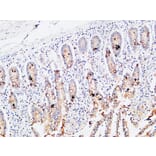Immunohistochemistry - Anti-IL3RA Antibody (C30233) - Antibodies.com