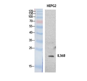 Western Blot - Anti-IL36B Antibody (C30613) - Antibodies.com
