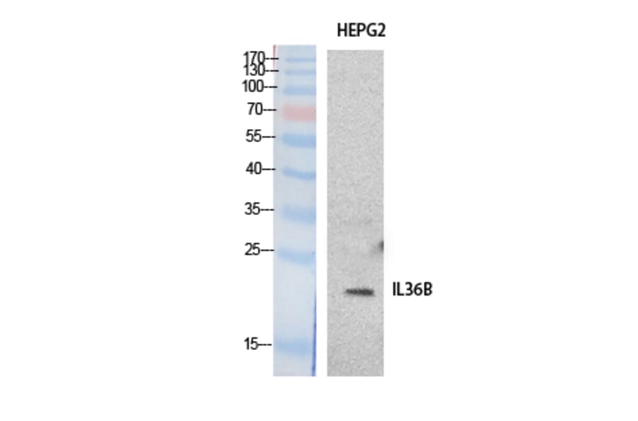 Western Blot - Anti-IL36B Antibody (C30613) - Antibodies.com