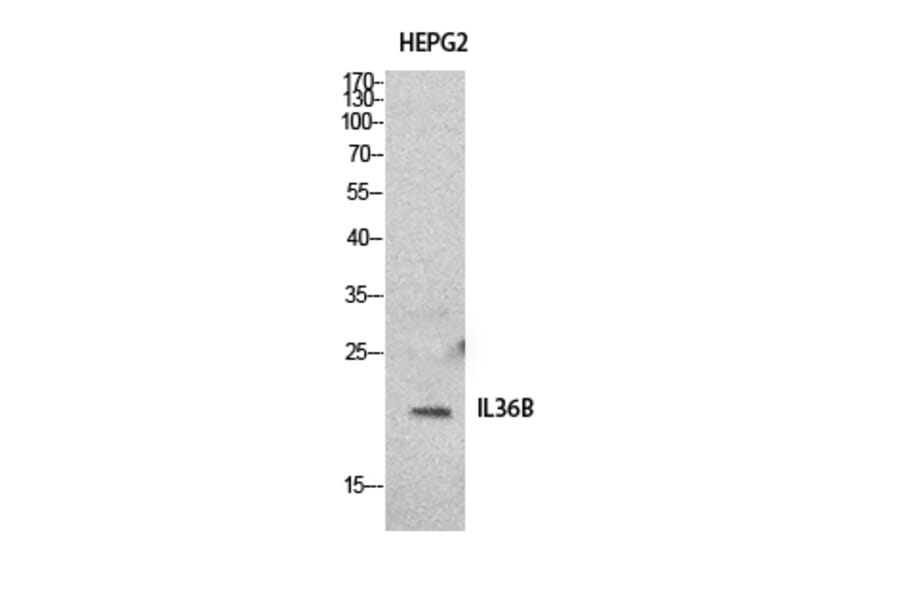 Western Blot - Anti-IL36B Antibody (C30613) - Antibodies.com