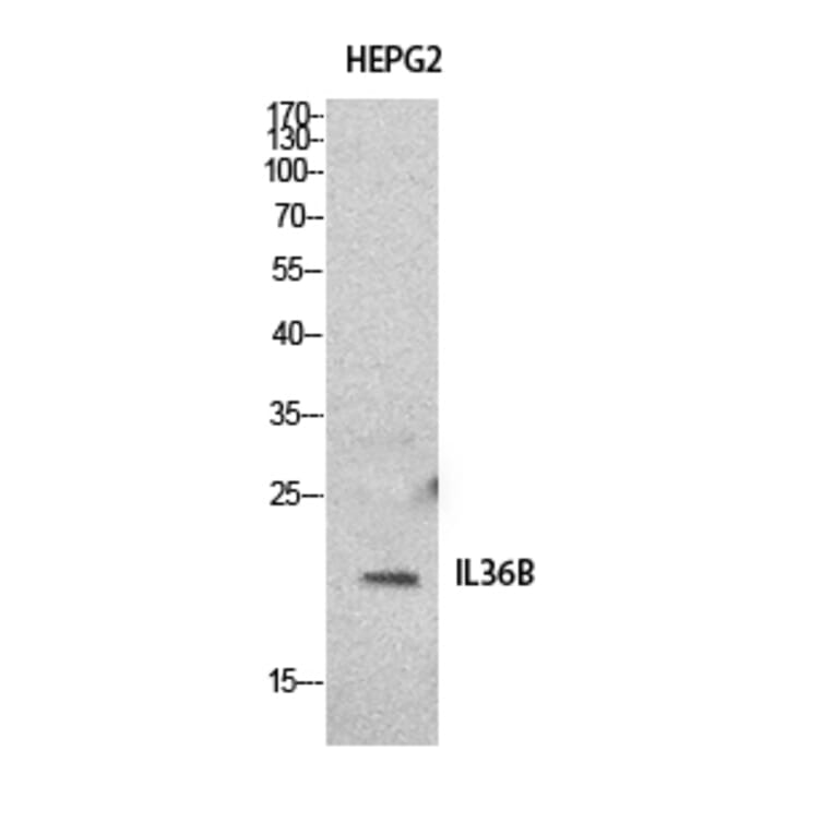 Western Blot - Anti-IL36B Antibody (C30613) - Antibodies.com