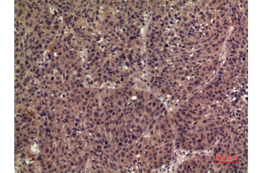Immunohistochemistry - Anti-IL36B Antibody (C30613) - Antibodies.com