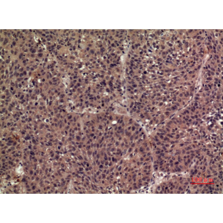 Immunohistochemistry - Anti-IL36B Antibody (C30613) - Antibodies.com
