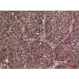 Immunohistochemistry - Anti-IL36B Antibody (C30613) - Antibodies.com