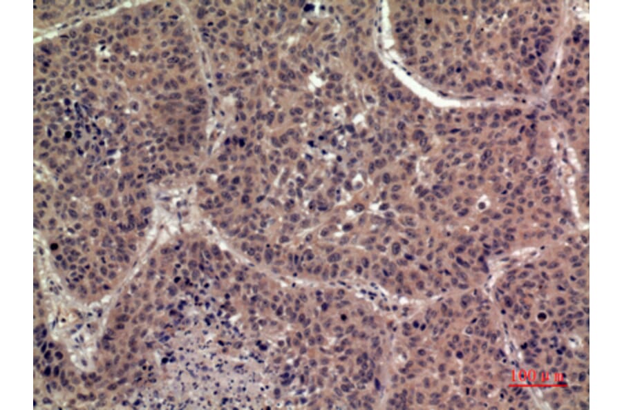 Immunohistochemistry - Anti-IL36B Antibody (C30613) - Antibodies.com