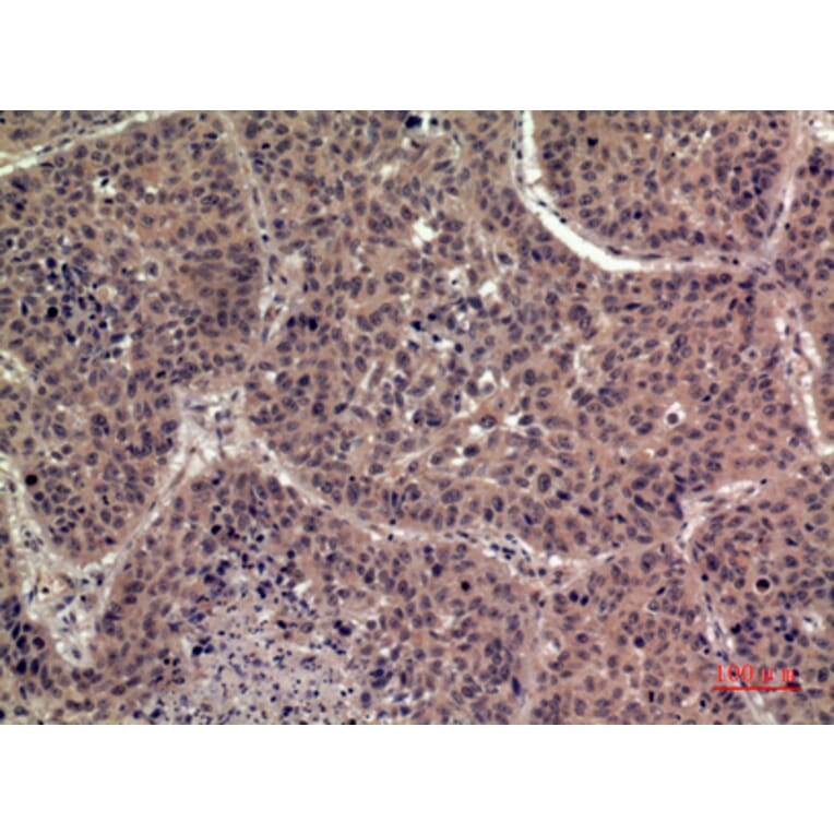 Immunohistochemistry - Anti-IL36B Antibody (C30613) - Antibodies.com
