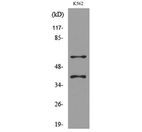 Western Blot - Anti-IL2RG Antibody (C30232) - Antibodies.com