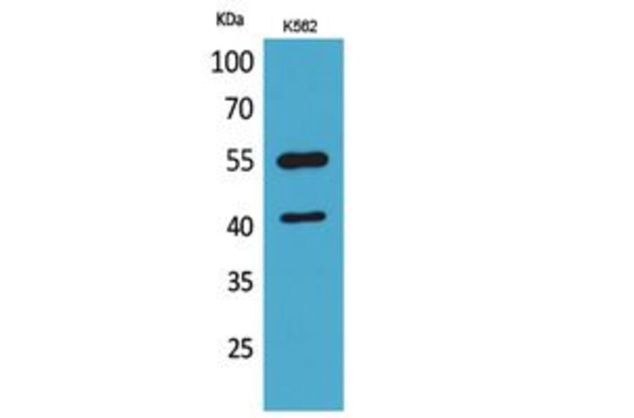 Western Blot - Anti-IL2RG Antibody (C30232) - Antibodies.com