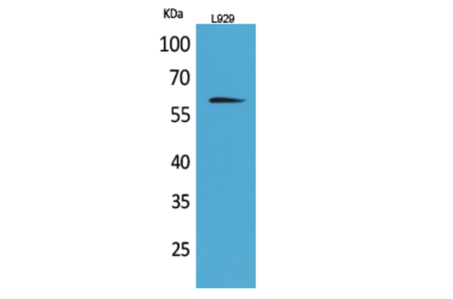 Western Blot - Anti-IL2RB Antibody (C30424) - Antibodies.com