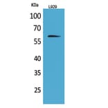 Western Blot - Anti-IL2RB Antibody (C30424) - Antibodies.com