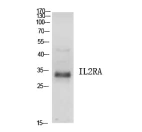 Western Blot - Anti-IL2RA Antibody (C30337) - Antibodies.com