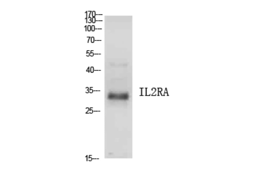 Western Blot - Anti-IL2RA Antibody (C30337) - Antibodies.com