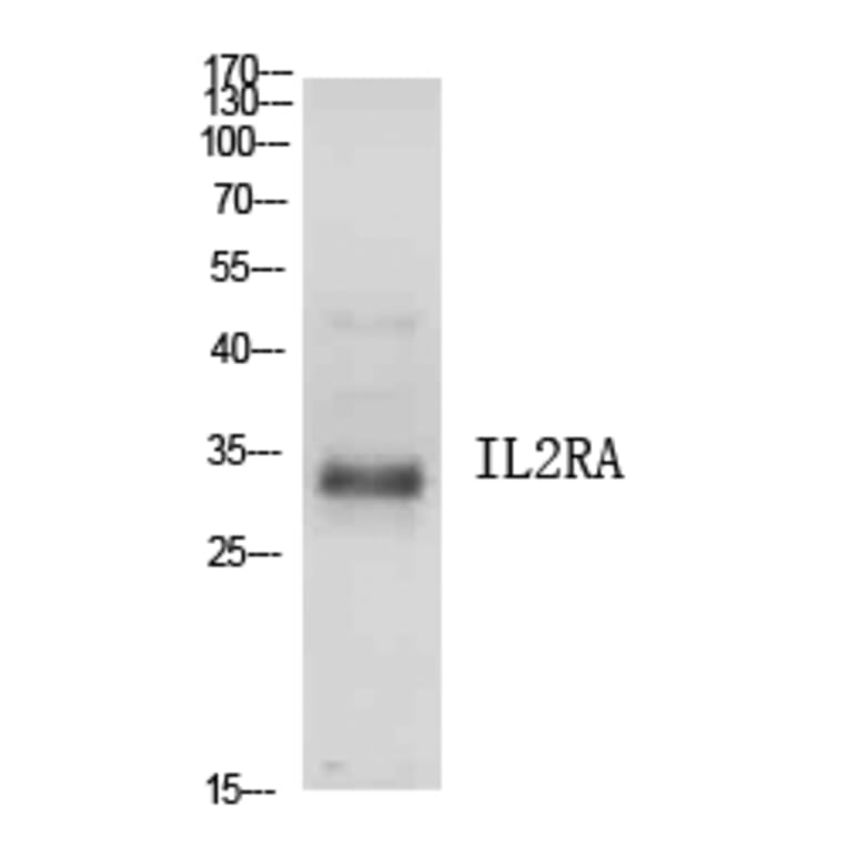 Western Blot - Anti-IL2RA Antibody (C30337) - Antibodies.com