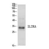 Western Blot - Anti-IL2RA Antibody (C30337) - Antibodies.com