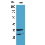 Western Blot - Anti-IL2RA Antibody (C30337) - Antibodies.com