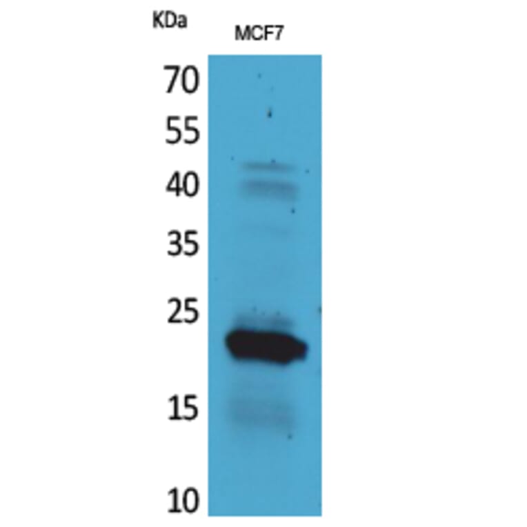 Western Blot - Anti-IL28A Antibody (C30673) - Antibodies.com