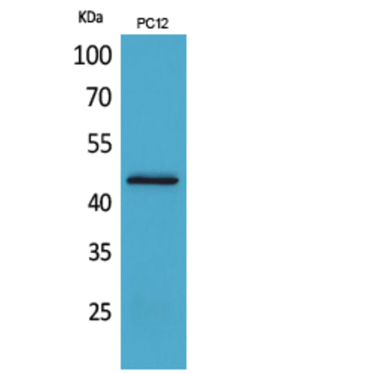 Western Blot - Anti-IL1R2 Antibody (C30423) - Antibodies.com