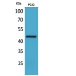 Western Blot - Anti-IL1R2 Antibody (C30423) - Antibodies.com