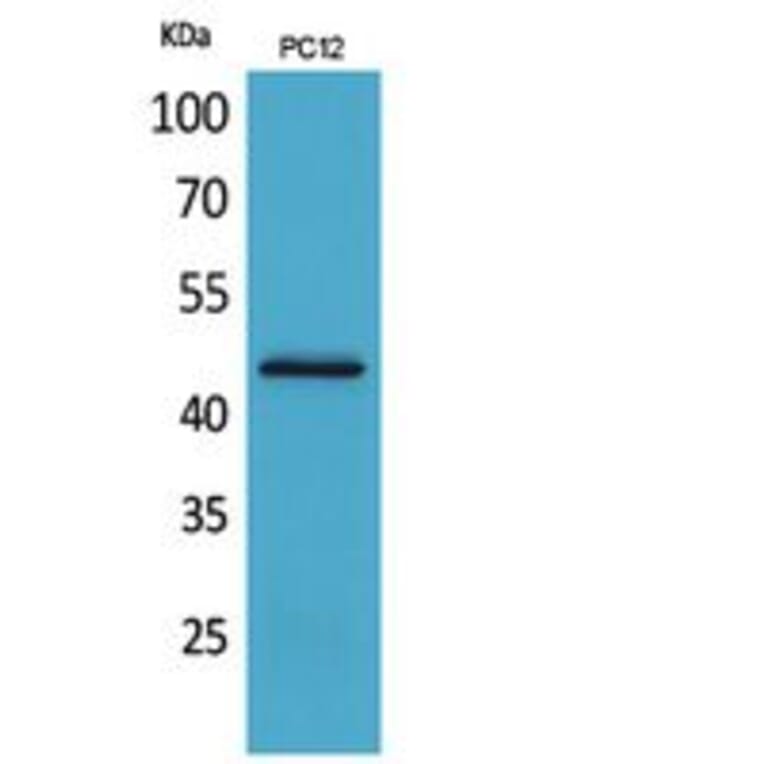 Western Blot - Anti-IL1R2 Antibody (C30423) - Antibodies.com