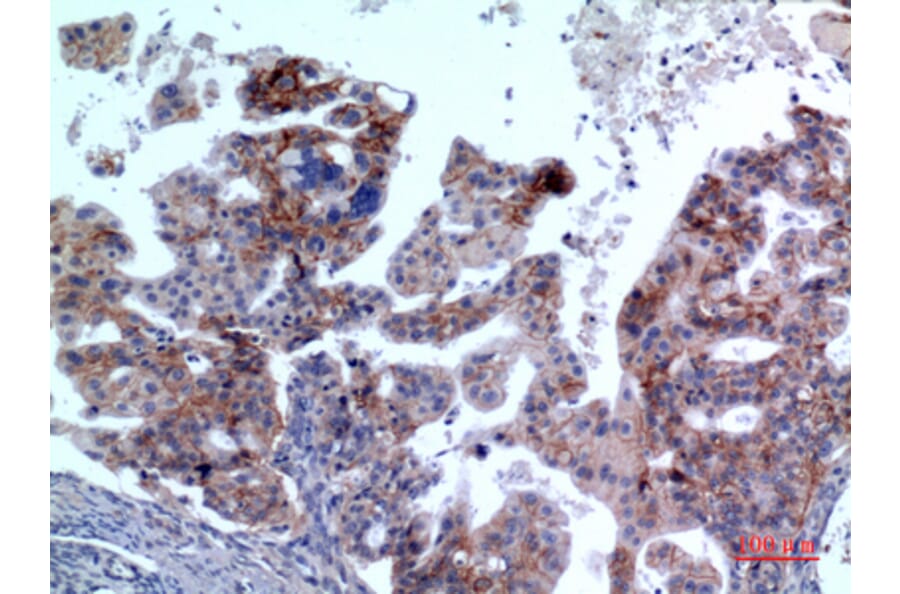 Immunohistochemistry - Anti-IL1R2 Antibody (C30423) - Antibodies.com