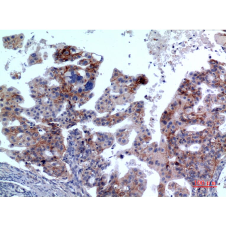 Immunohistochemistry - Anti-IL1R2 Antibody (C30423) - Antibodies.com