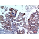 Immunohistochemistry - Anti-IL1R2 Antibody (C30423) - Antibodies.com