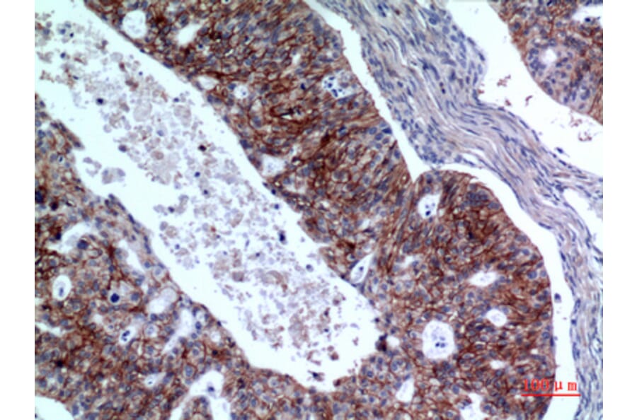 Immunohistochemistry - Anti-IL1R2 Antibody (C30423) - Antibodies.com