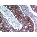 Immunohistochemistry - Anti-IL1R2 Antibody (C30423) - Antibodies.com