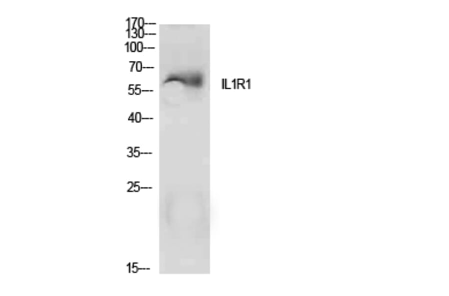 Western Blot - Anti-IL1R1 Antibody (C30422) - Antibodies.com