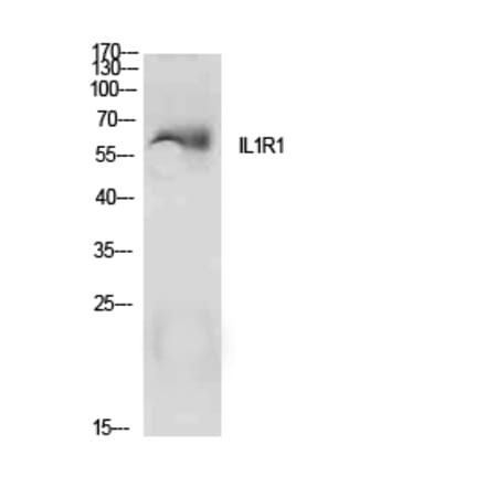 Western Blot - Anti-IL1R1 Antibody (C30422) - Antibodies.com