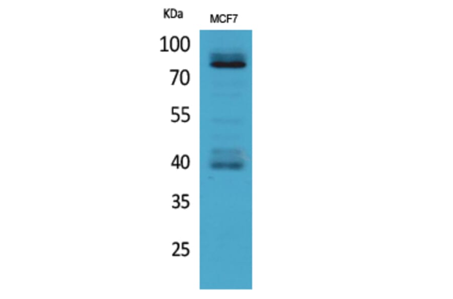Western Blot - Anti-IL1R1 Antibody (C30422) - Antibodies.com