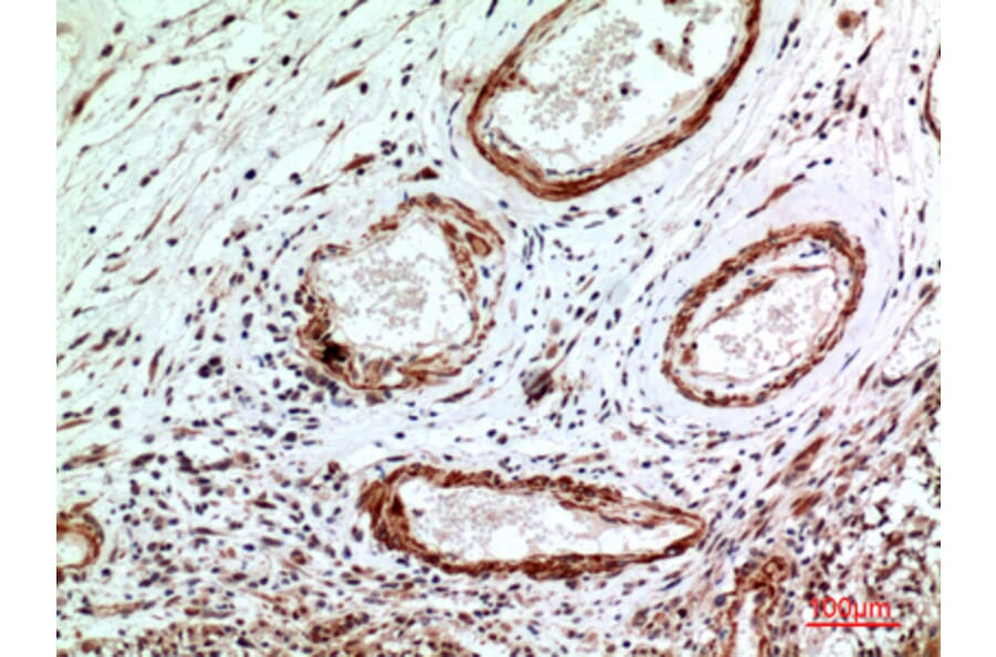 Immunohistochemistry - Anti-IL1R1 Antibody (C30422) - Antibodies.com