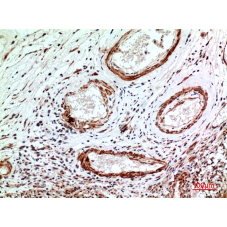 Immunohistochemistry - Anti-IL1R1 Antibody (C30422) - Antibodies.com