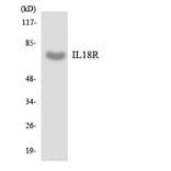 Western Blot - Anti-IL18R Antibody (R12-2921) - Antibodies.com