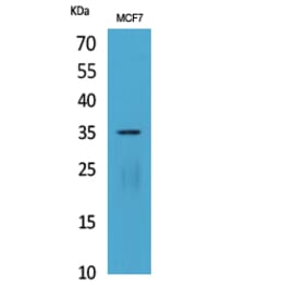 Western Blot - Anti-IL12A Antibody (C30103) - Antibodies.com