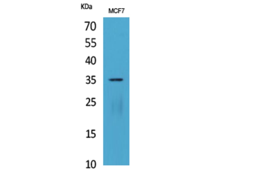 Western Blot - Anti-IL12A Antibody (C30103) - Antibodies.com