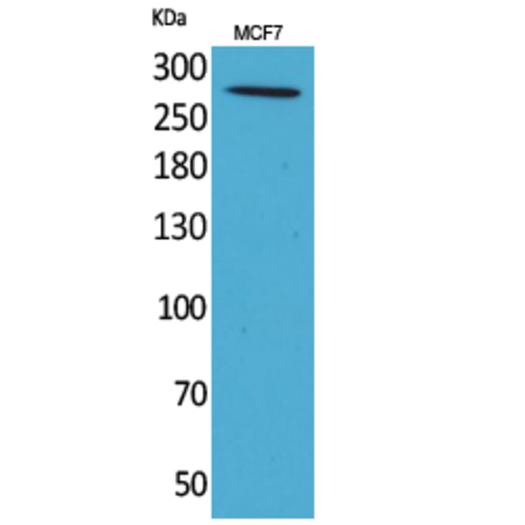 Western Blot - Anti-IGF2R Antibody (C30461) - Antibodies.com