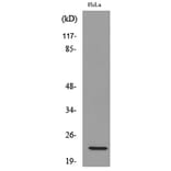 Western Blot - Anti-IFNW1 Antibody (C30712) - Antibodies.com