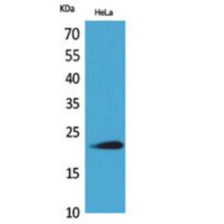 Western Blot - Anti-IFNW1 Antibody (C30712) - Antibodies.com