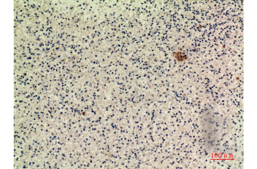 Immunohistochemistry - Anti-IFNW1 Antibody (C30712) - Antibodies.com