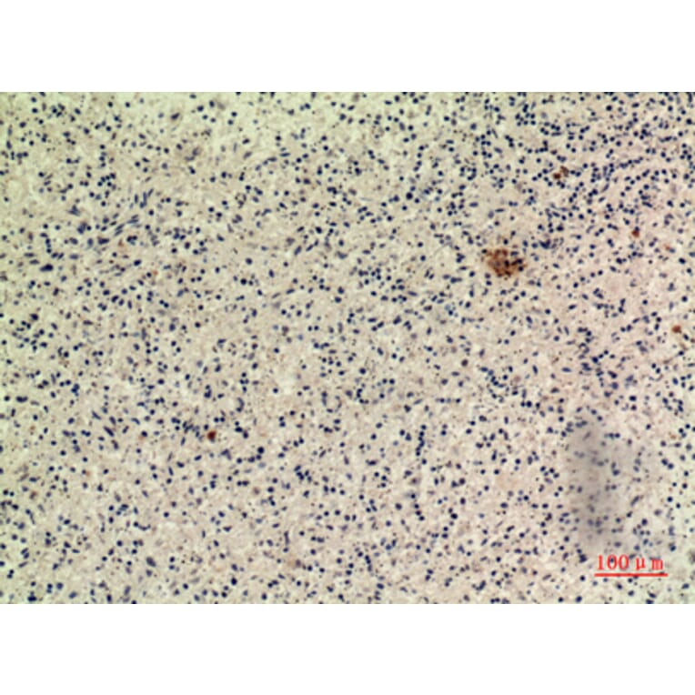 Immunohistochemistry - Anti-IFNW1 Antibody (C30712) - Antibodies.com