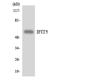 Western Blot - Anti-IFIT5 Antibody (R12-2911) - Antibodies.com
