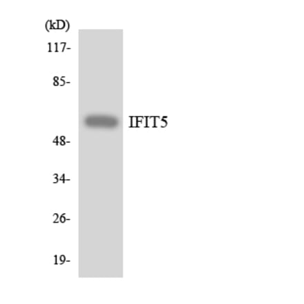 Western Blot - Anti-IFIT5 Antibody (R12-2911) - Antibodies.com
