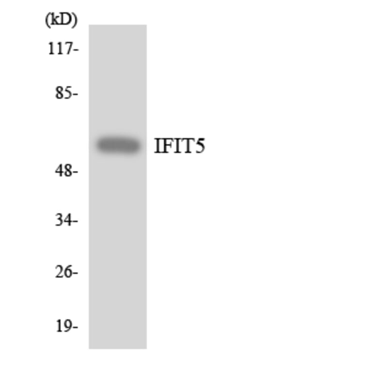 Western Blot - Anti-IFIT5 Antibody (R12-2911) - Antibodies.com