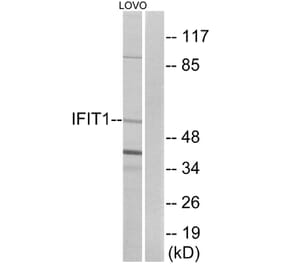 Western Blot - Anti-IFIT1 Antibody (C12456) - Antibodies.com