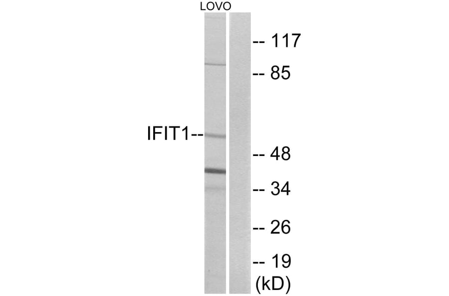 Western Blot - Anti-IFIT1 Antibody (C12456) - Antibodies.com