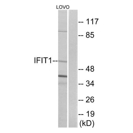 Western Blot - Anti-IFIT1 Antibody (C12456) - Antibodies.com