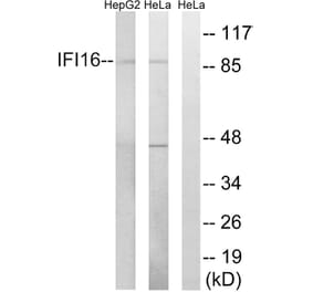 Western Blot - Anti-IFI16 Antibody (C15867) - Antibodies.com