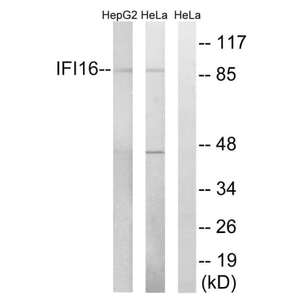 Western Blot - Anti-IFI16 Antibody (C15867) - Antibodies.com