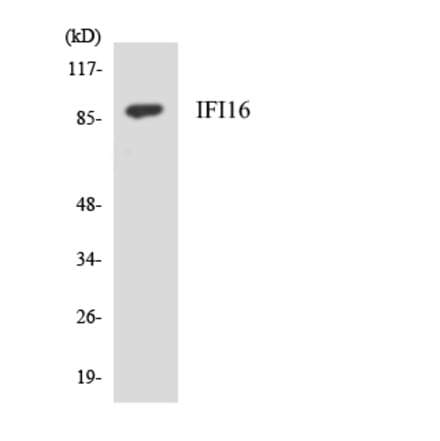 Western Blot - Anti-IFI16 Antibody (R12-2910) - Antibodies.com